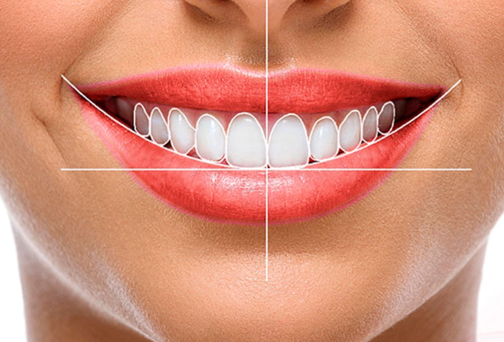 Cosmetic dentistry Pros and cons of dental cosmetics