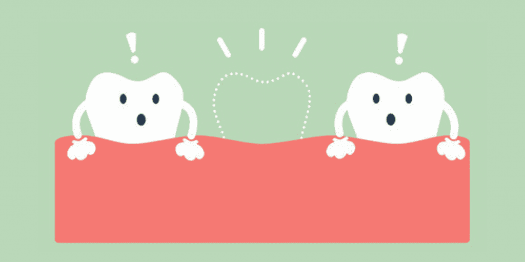 what is tooth agenesis