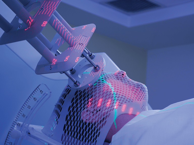 Dental Health During Chemotherapy Side Effects and Prevention