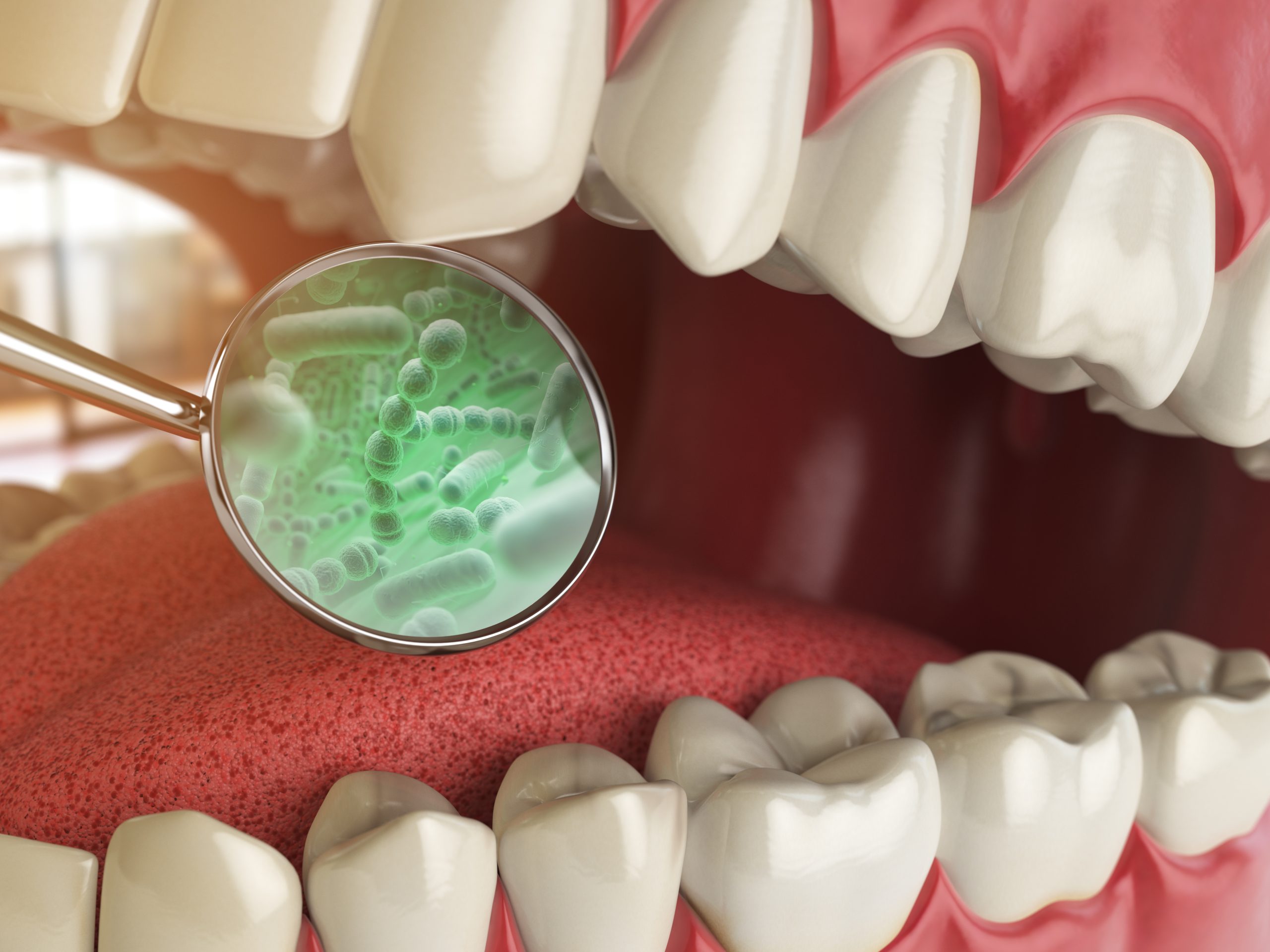 oral pathology