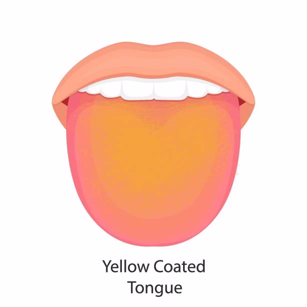 yellow tongue