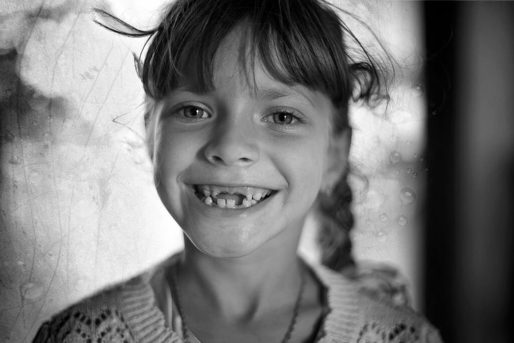 The Psychological Effects of Missing Teeth: Mental Health Matters